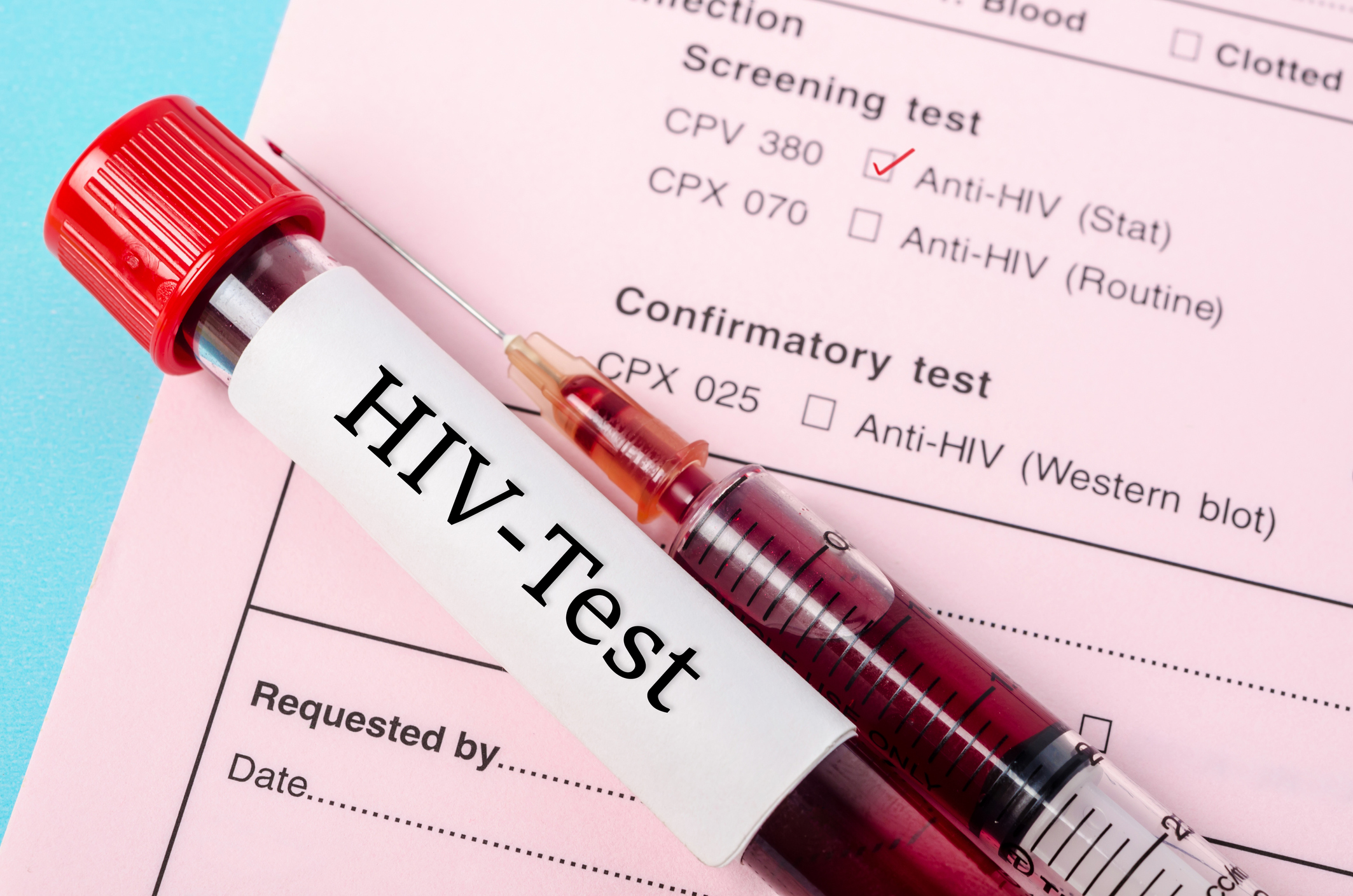Lood. Тест на ВИЧ. Исследование на ВИЧ инфекцию. Тест на ВИЧ инфекцию.